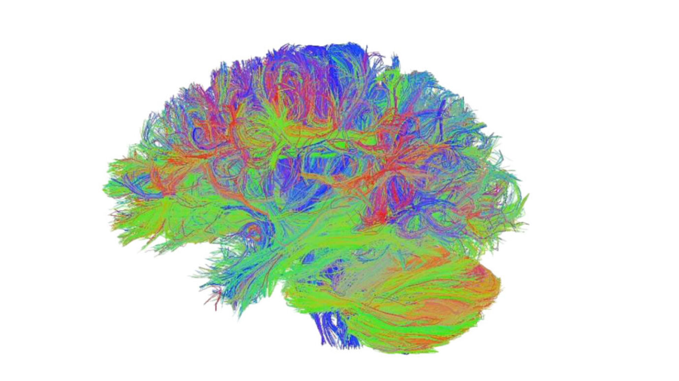 Scientists Say: Connectome