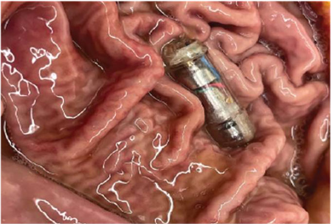 a photo showing a VIBES pill vibrating inside a pig stomach