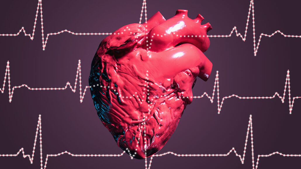 a model of a uman heart behind illustrated ECG traces